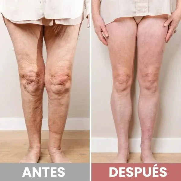 NEUROFLEX - TAPETE ELÉCTRICO PARA DOLOR DE PIES