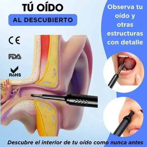 CeruClear® (Limpiador de Oídos Con Cámara Endoscopio)